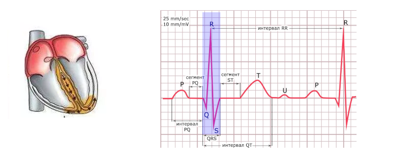 Схема формирования комплекса QRS на ЭКГ.